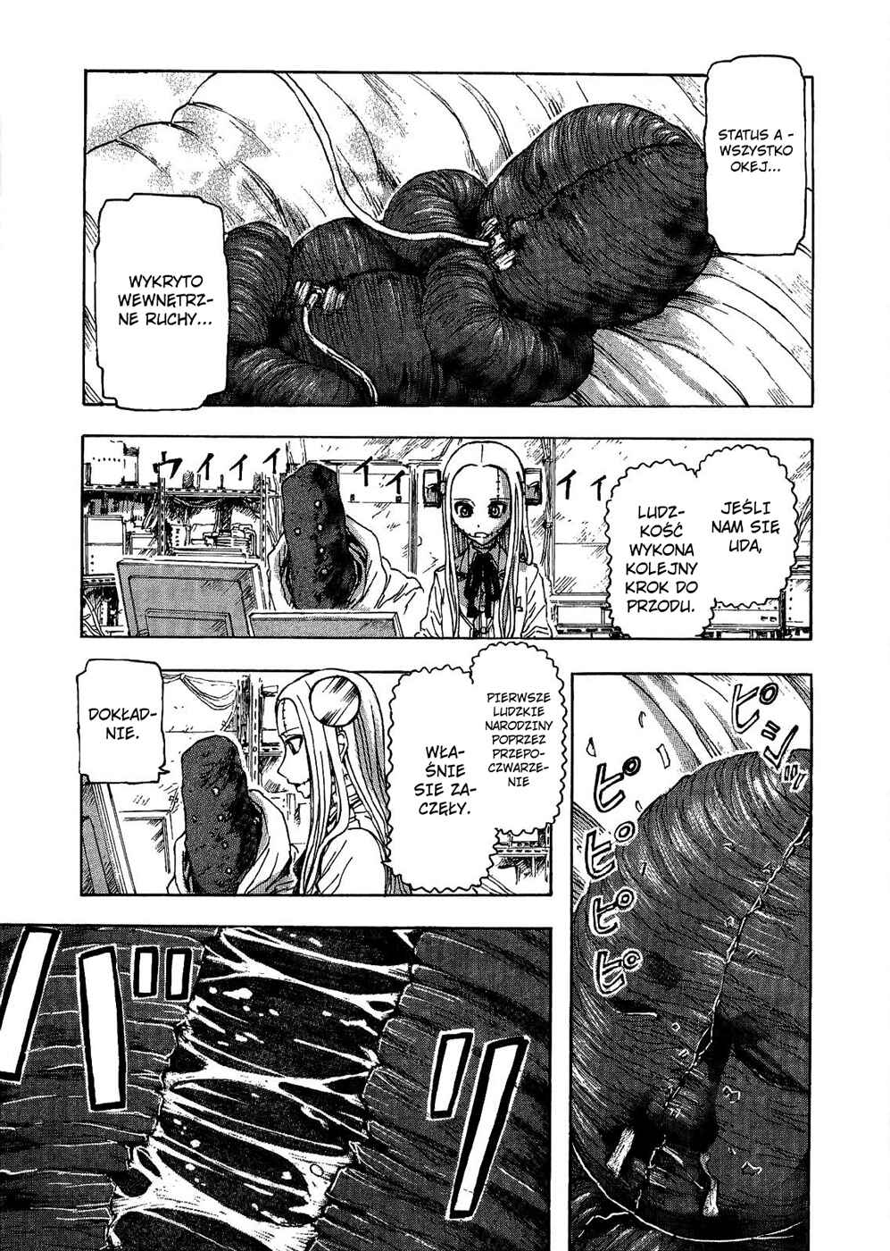 Franken Fran Chapter 29 - Page 2