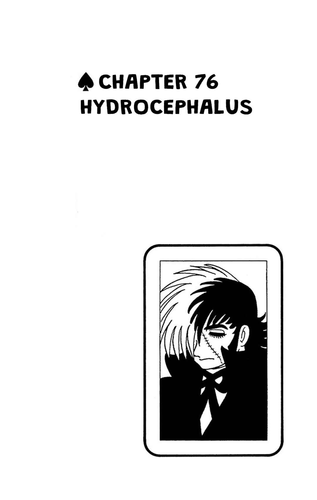 Black Jack Chapter 76 - Page 1