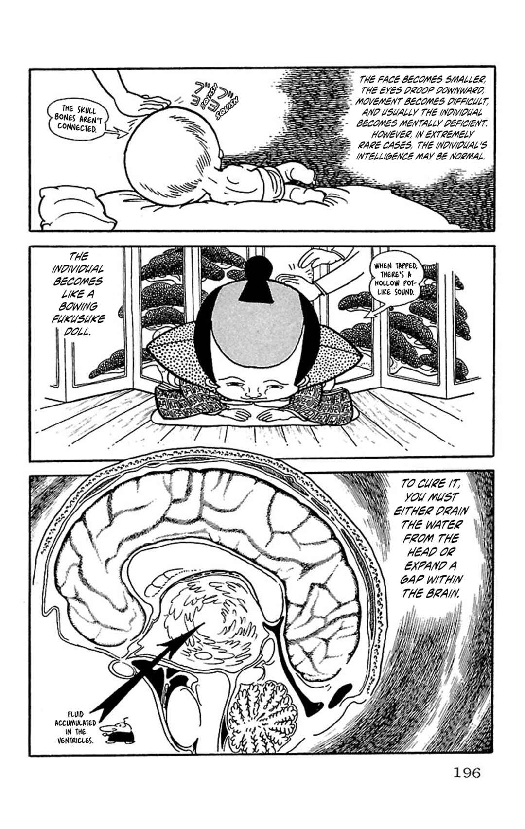 Black Jack Chapter 76 - Page 6