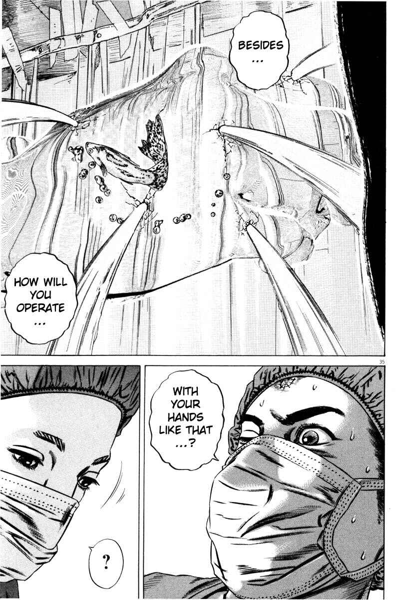 Homunculus Chapter ? - Page 38