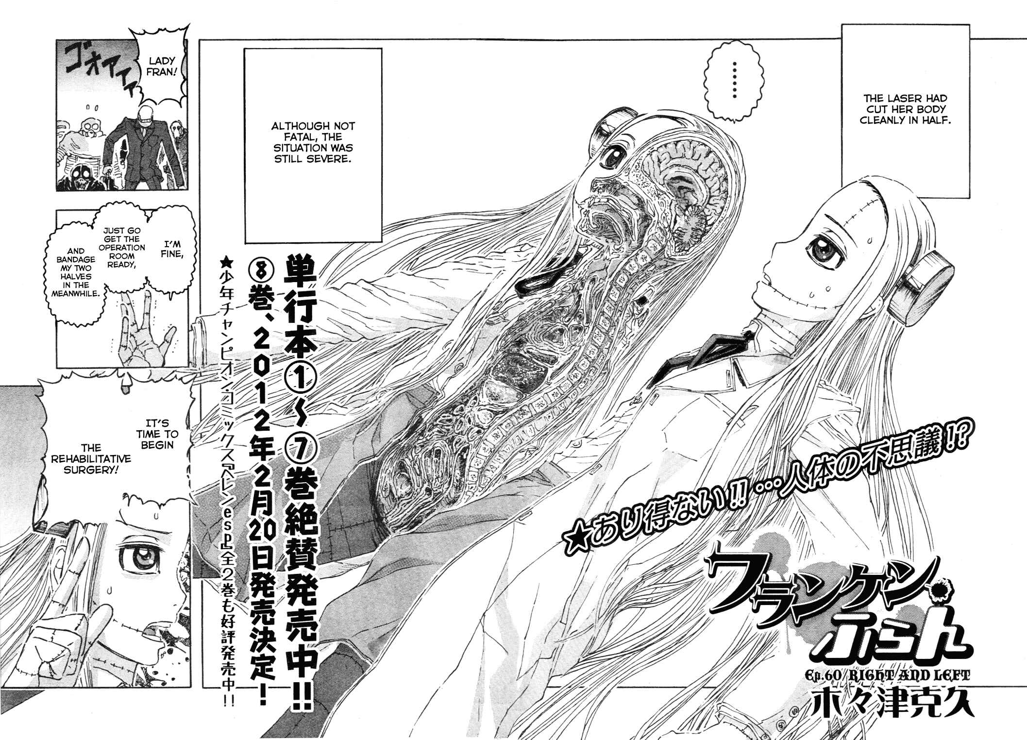 Franken Fran Chapter 60 - Page 3