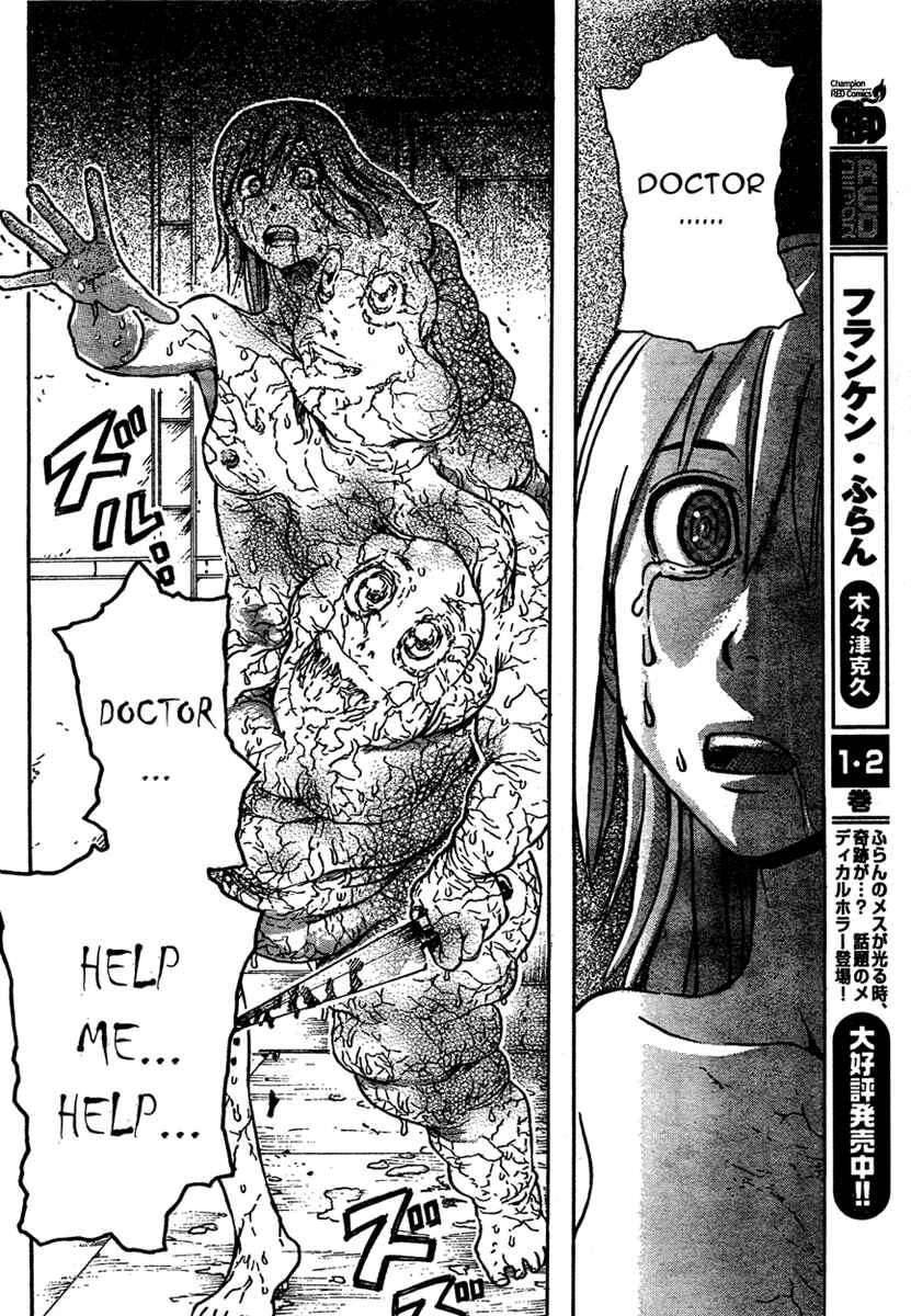 Franken Fran Chapter 22 - Page 15